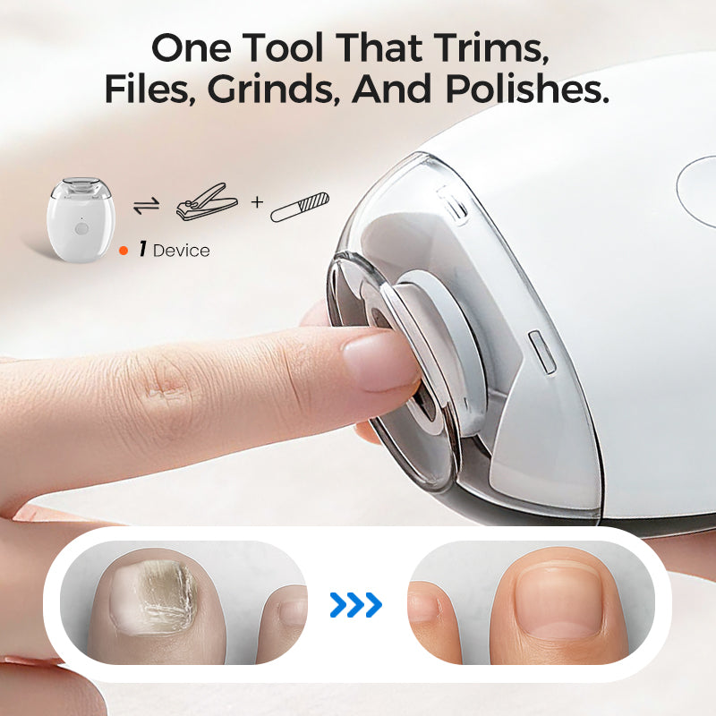💅✨Universelle automatische Nagelfeile für Erwachsene und Kinder👶🔧