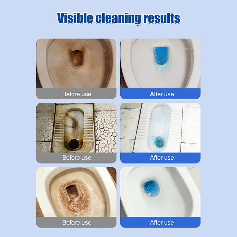 🧹✨ Frühjahrsputz-Aktion: 50% Rabatt! Zitronenduft-Toilettenreinigungs­tabletten 💪🌸 – kraftvoll gegen Kalk & Schmutz, langanhaltend frisch, mühelose Sauberkeit für strahlend gepflegtes Bad!